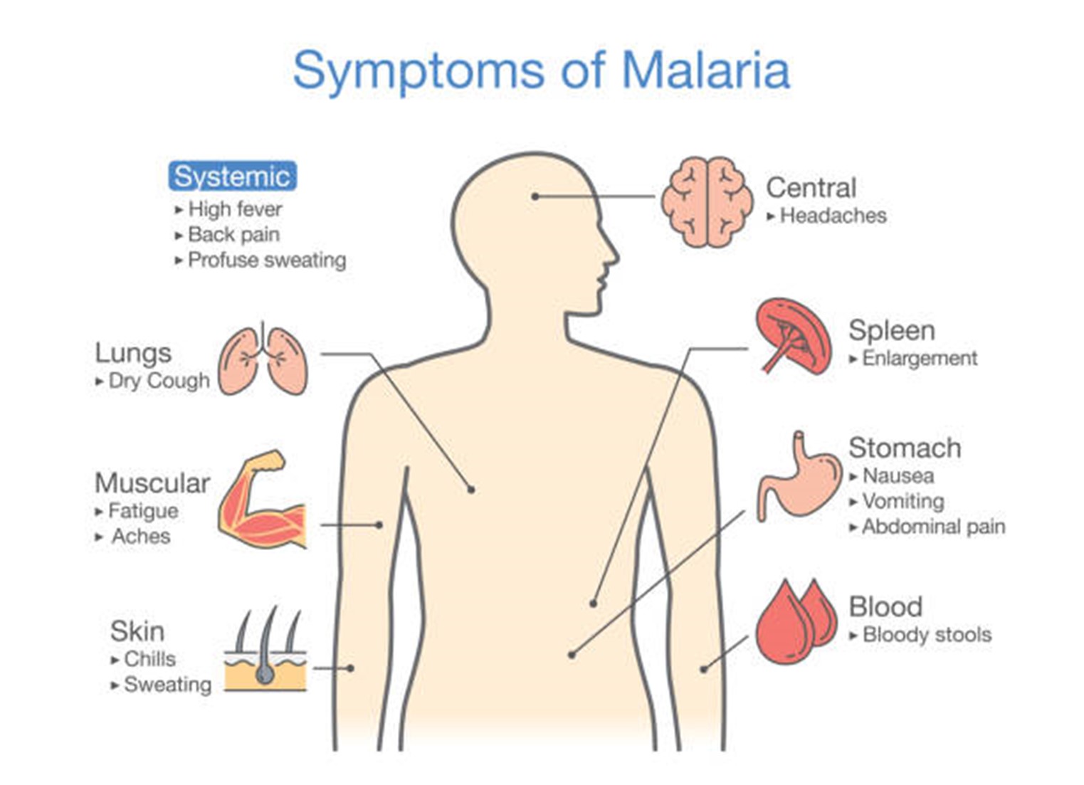 Figure 3: Symptoms of Malaria. The Travel Doctor.